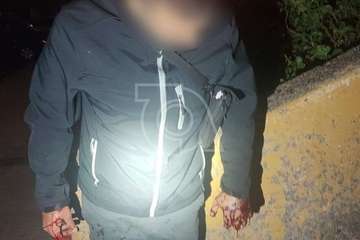 Tiroteo en Lomo de las Brujas de Jinámar con dos heridos/TA.